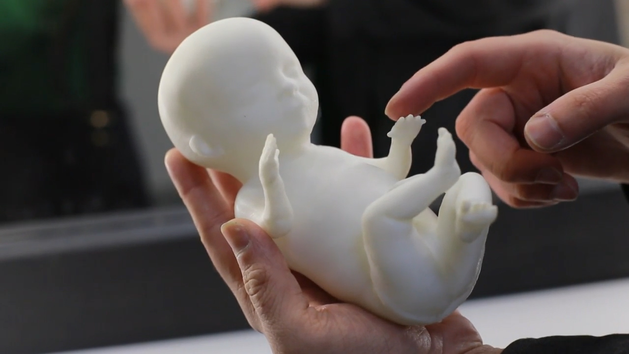 Parents can now own gold plated 3D printed models of their unborn kids!