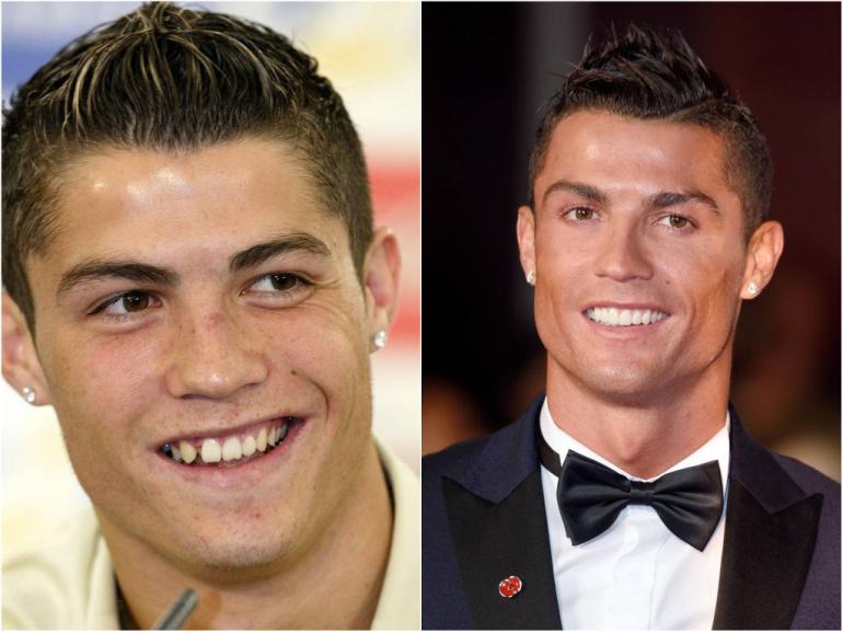 Cristiano Ronaldo Million Dollars Smile